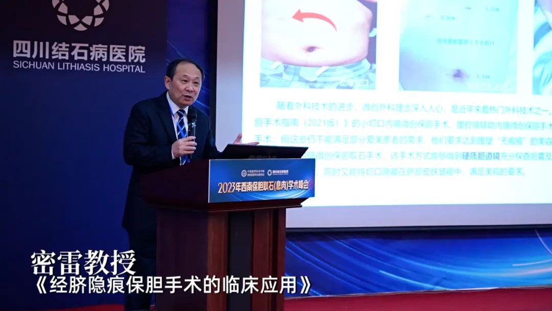 全国知名保胆专家齐聚:高规格、高水平保胆学术会议在四川结石病医院隆重召开!(图10) 全国知名保胆专家齐聚:高规格、高水平保胆学术会议在四川结石病医院隆重召开!(图10)