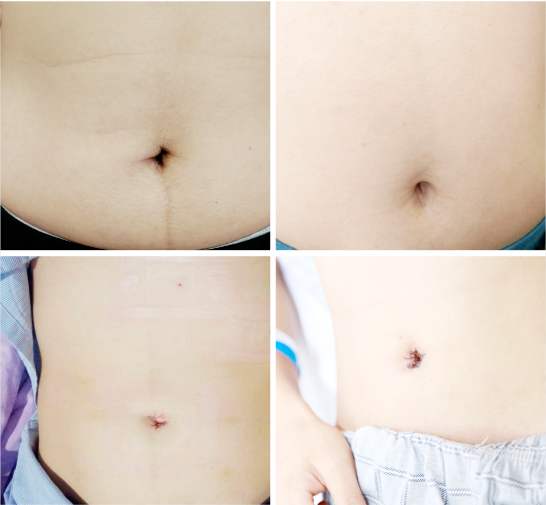 注意了!四川结石病医院提醒:节后这类疾病正在持续高发中!(图3) 注意了!四川结石病医院提醒:节后这类疾病正在持续高发中!(图3)