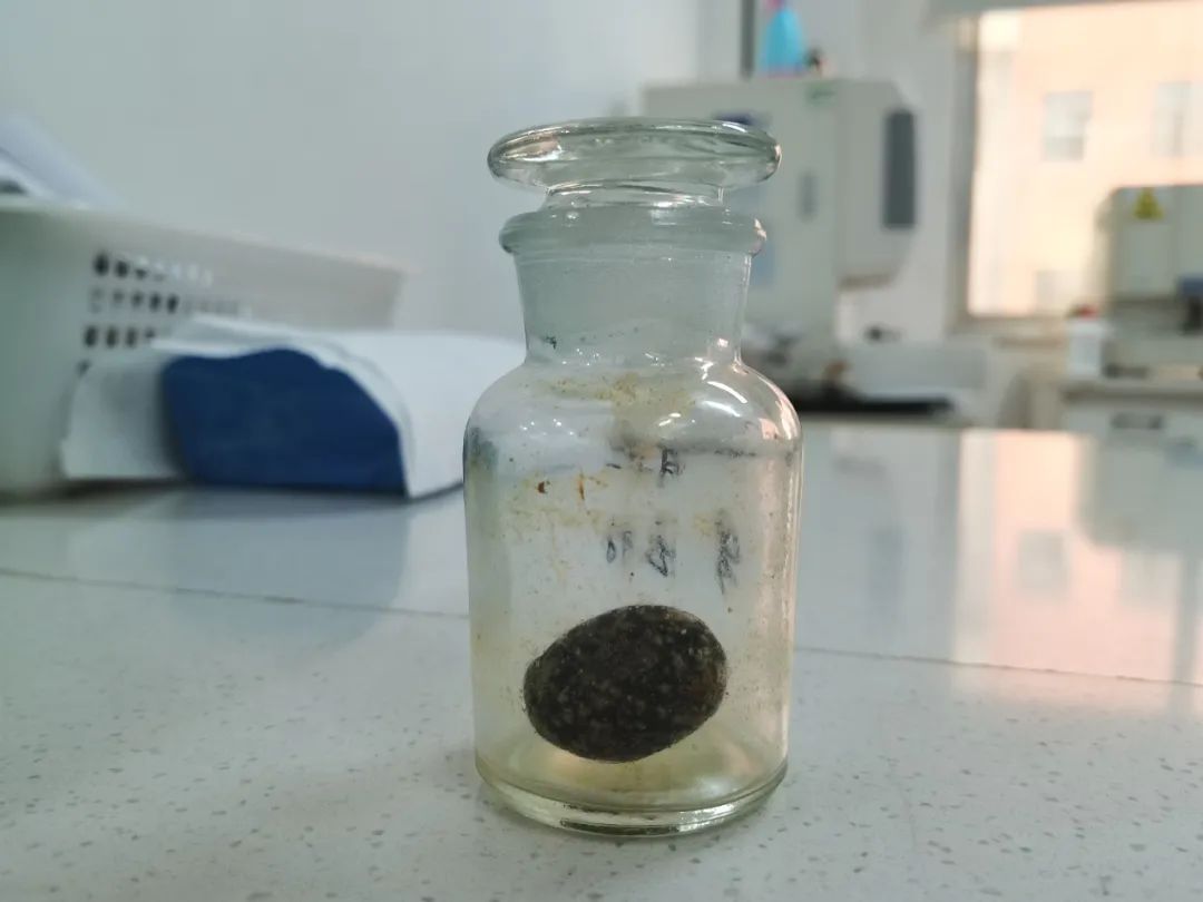 口碑见证!看到亲人们手术效果后,他也选择来四川结石病医院治结石(图1) 口碑见证!看到亲人们手术效果后,他也选择来四川结石病医院治结石(图1)