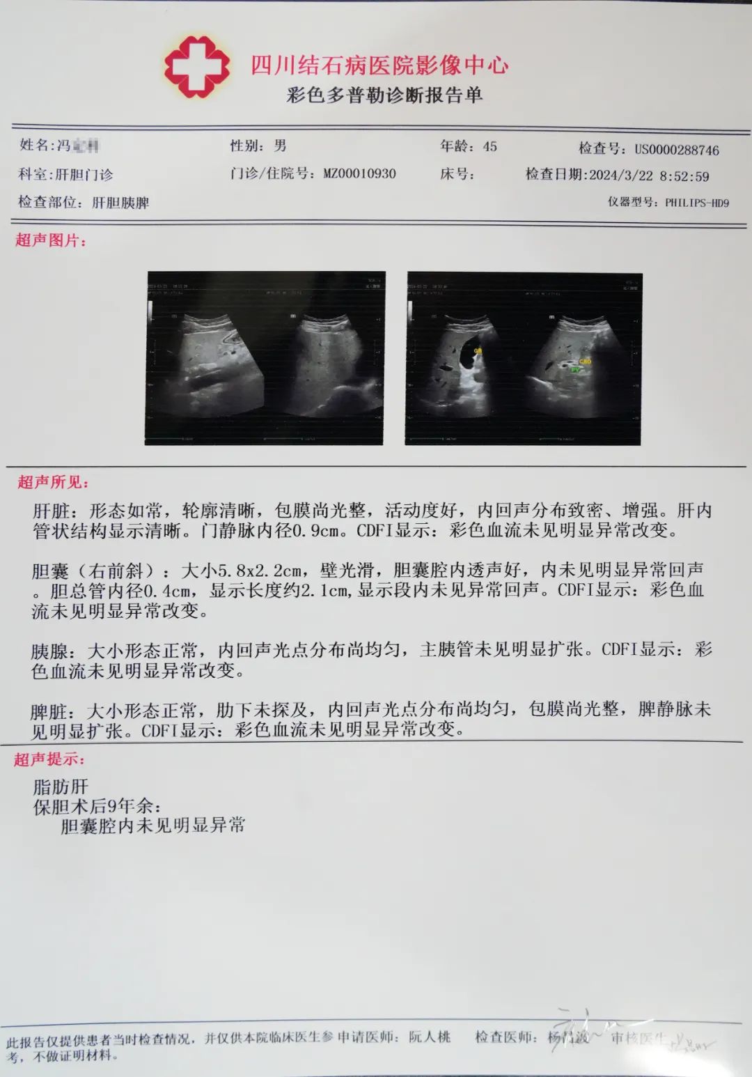 成都胆结石医院:保胆9年,他说医生的技术水平好,术后我一切正常(图1) 成都胆结石医院:保胆9年,他说医生的技术水平好,术后我一切正常(图1)