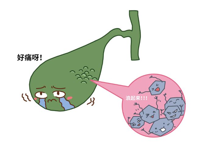 右上腹痛别当胃病！医生教你几招快速区分胆结石！【四川胆结石医院排名】(图3)