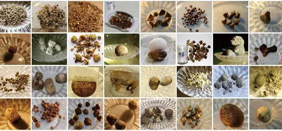 胆结石患者注意！这3个关键时机一错过，胆囊可能就保不住了【四川胆结石专科医院】(图2)