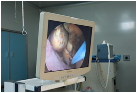 胆结石小≠小事情？轻视胆结石，后果远比你想象的严重【四川胆结石专科医院】(图5)